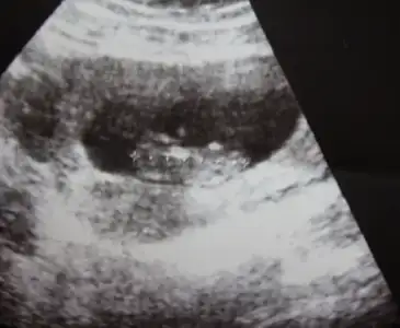 $Tam ekran yakalama 18.02.2014 160129.bmp.webp