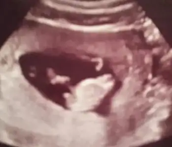 $2014-02-26 17.11.07.webp