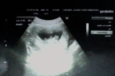 $FotoÃ°raf - 10.03.2014 18.31 #2.webp