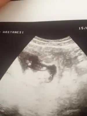 $ImageUploadedByKadÃÂ±nlar KuluÃËbuÃË1394960952.211916.webp