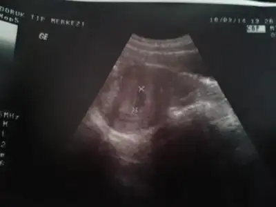 $2014-03-18 14.44.24.webp