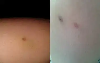 $Ekran AlÃ½ntÃ½sÃ½.webp