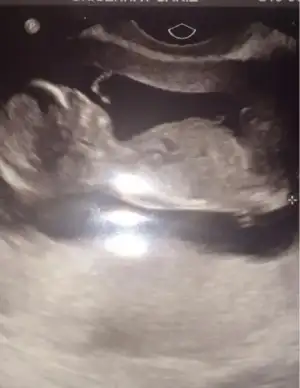 $ImageUploadedByKadÃÂ±nlar KuluÃËbuÃË1396122781.122069.webp