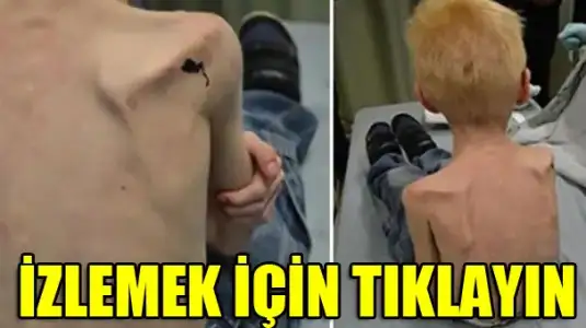 $kendi-cocuklarina-bunu-yaptilar-4223316.webp $kendi-cocuklarina-bunu-yaptilar-4223316.webp