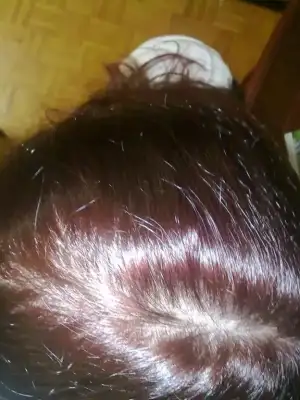 $100820101836.webp