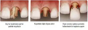 $ImageUploadedByKadÃÂ±nlar KuluÃËbuÃË1397502931.086312.webp