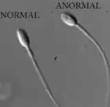 $sperm.webp