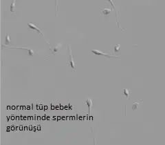 $normal tüp bebek.webp $normal tüp bebek.webp