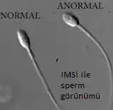$sperm.webp