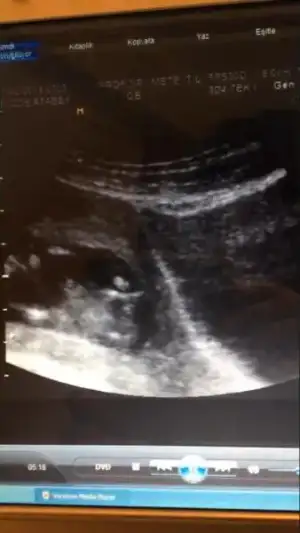 $ImageUploadedByKadÃÂ±nlar KuluÃËbuÃË1398251579.717078.webp