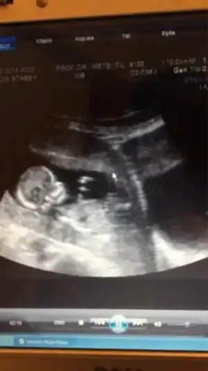 $ImageUploadedByKadÃÂ±nlar KuluÃËbuÃË1398251598.562961.webp