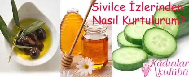 $sivilce_izlerinden_nasil_kurtulurum.webp