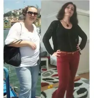 $Ã¶ncesi sonrasÃ½.webp