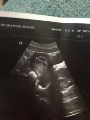 $ImageUploadedByKadÃÂ±nlar KuluÃËbuÃË1400172780.041614.webp