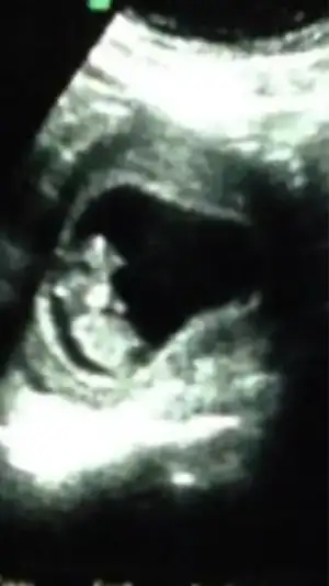 $ImageUploadedByKadÃÂ±nlar KuluÃËbuÃË1400696910.209995.webp