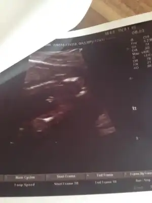 $ImageUploadedByKadÃÂ±nlar KuluÃËbuÃË1400767026.064394.webp