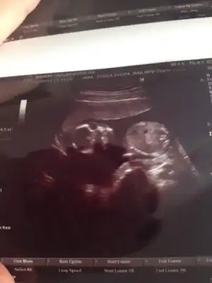 $ImageUploadedByKadÃÂ±nlar KuluÃËbuÃË1400767039.743275.webp