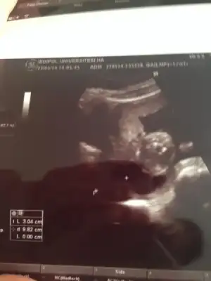 $ImageUploadedByKadÃÂ±nlar KuluÃËbuÃË1400767054.037599.webp