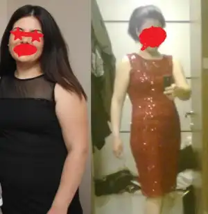 $önce-sonra2.webp $önce-sonra2.webp