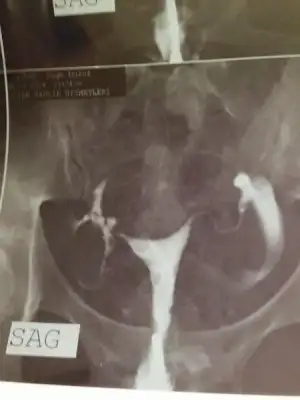 $ImageUploadedByKadÃÂ±nlar KuluÃËbuÃË1401291678.295599.webp