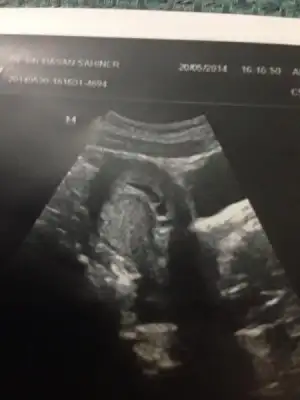 $ImageUploadedByKadÃÂ±nlar KuluÃËbuÃË1401469668.112698.webp