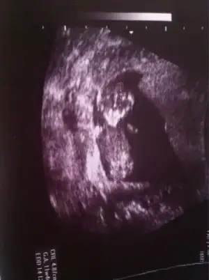 $ImageUploadedByKadÃÂ±nlar KuluÃËbuÃË1401834897.119567.webp