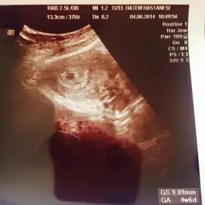 $ImageUploadedByKadÃÂ±nlar KuluÃËbuÃË1401872528.634222.webp