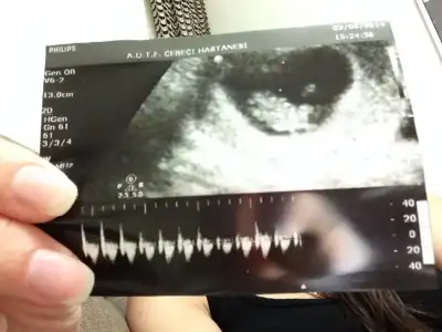 $ImageUploadedByKadÃÂ±nlar KuluÃËbuÃË1401905413.950356.webp