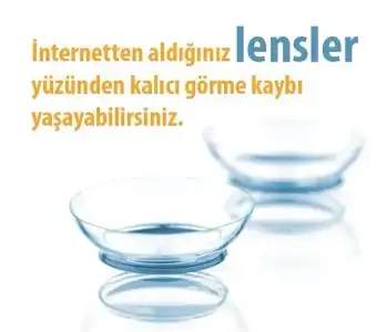 $Ãnternetten aldÃ½Ã°Ã½nÃ½z lensler.webp