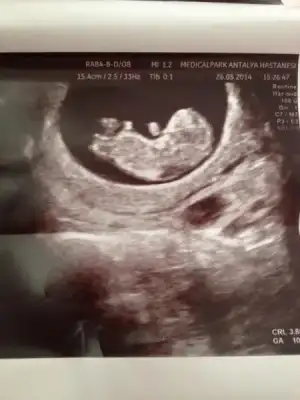 $ImageUploadedByKadÃÂ±nlar KuluÃËbuÃË1402142411.513398.webp