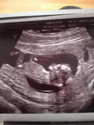 $ImageUploadedByKadÃÂ±nlar KuluÃËbuÃË1402142438.322017.webp