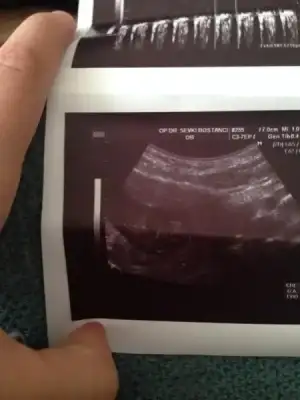 $ImageUploadedByKadÃÂ±nlar KuluÃËbuÃË1402413606.651356.webp