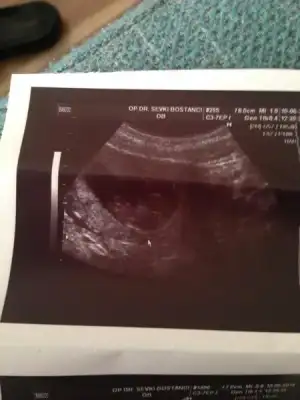 $ImageUploadedByKadÃÂ±nlar KuluÃËbuÃË1402413637.873570.webp