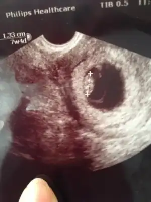 $ImageUploadedByKadÃÂ±nlar KuluÃËbuÃË1402414118.357691.webp