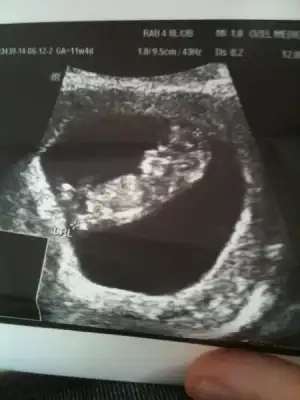 $ImageUploadedByKadÃÂ±nlar KuluÃËbuÃË1402567779.543712.webp