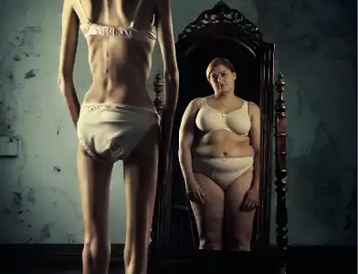 $anorexia1.webp