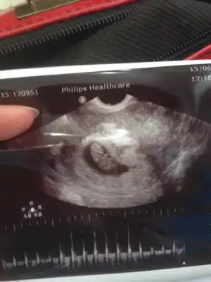 $ImageUploadedByKadÃÂ±nlar KuluÃËbuÃË1402751027.851702.webp