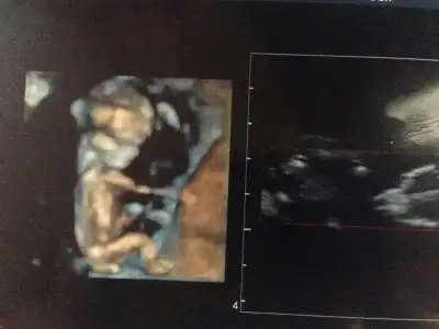 $fotoðraf.webp $fotoðraf.webp