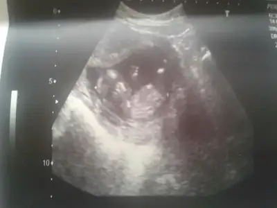 $1403181216911.webp