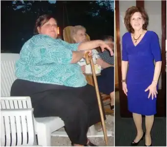 $275-extreme-weight-loss-before-after-women1.webp