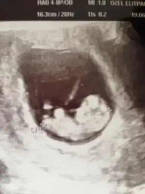 $ImageUploadedByKadÃÂ±nlar KuluÃËbuÃË1403272436.971732.webp