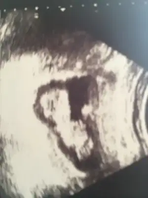 $ImageUploadedByKadÃÂ±nlar KuluÃËbuÃË1403278084.788939.webp