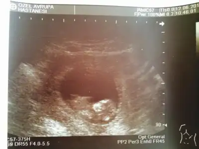 $ImageUploadedByKadÃÂ±nlar KuluÃËbuÃË1403278108.463447.webp