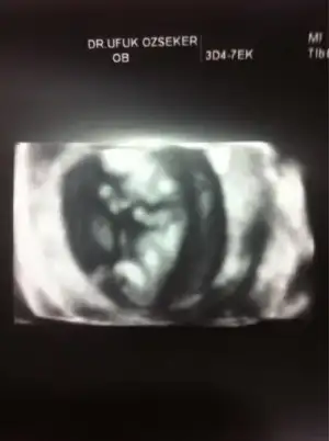 $ImageUploadedByKadÃÂ±nlar KuluÃËbuÃË1403706754.709813.webp