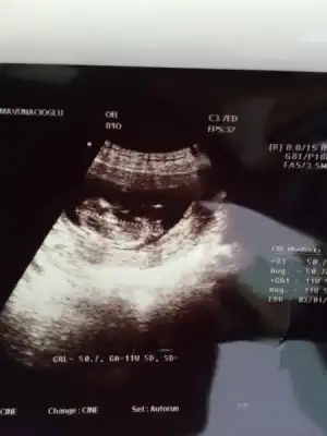 $ImageUploadedByKadÃÂ±nlar KuluÃËbuÃË1403871661.181270.webp