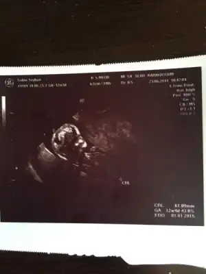 $ImageUploadedByKadÃÂ±nlar KuluÃËbuÃË1403871674.160859.webp