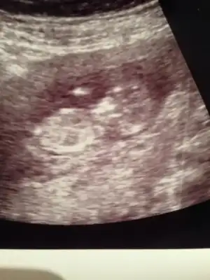 $ImageUploadedByKadÃÂ±nlar KuluÃËbuÃË1403971952.576968.webp