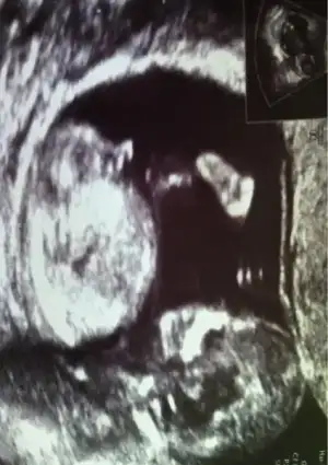 $ImageUploadedByKadÃÂ±nlar KuluÃËbuÃË1404090897.614037.webp