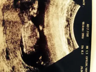 $ImageUploadedByKadÃÂ±nlar KuluÃËbuÃË1404109015.024725.webp