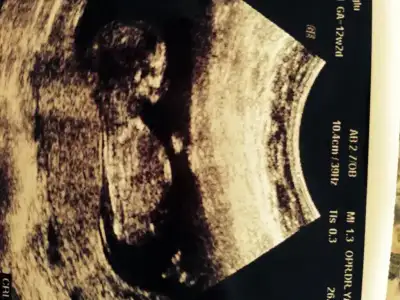 $ImageUploadedByKadÃÂ±nlar KuluÃËbuÃË1404127526.844957.webp